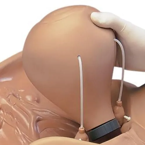 48 Hour Postpartum Uterus for S504.100
