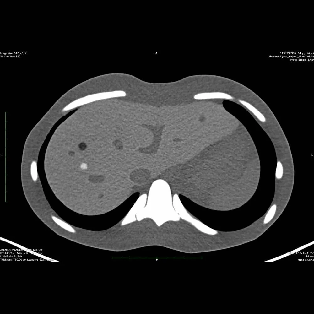 Dual Modality Human Abdomen Phantom (CT, Ultrasound)