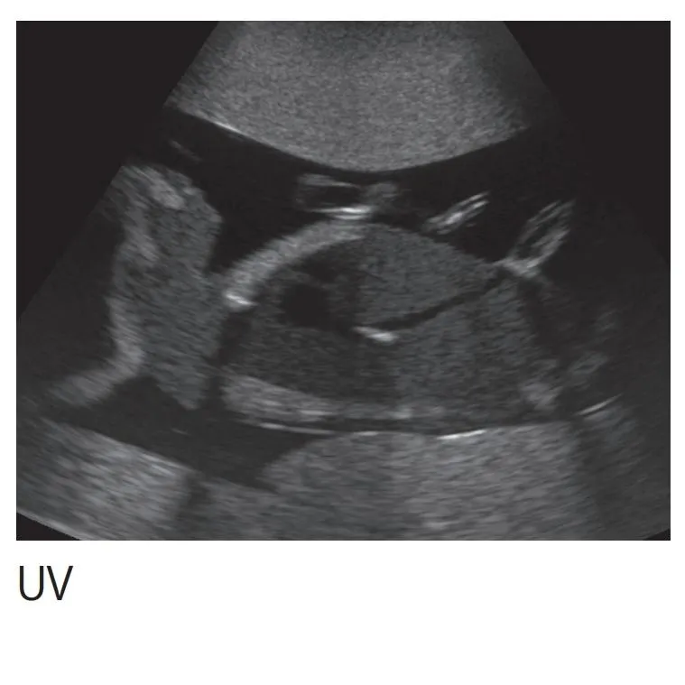 Fetus Ultrasound Exam Phantom SPACE FAN-ST
