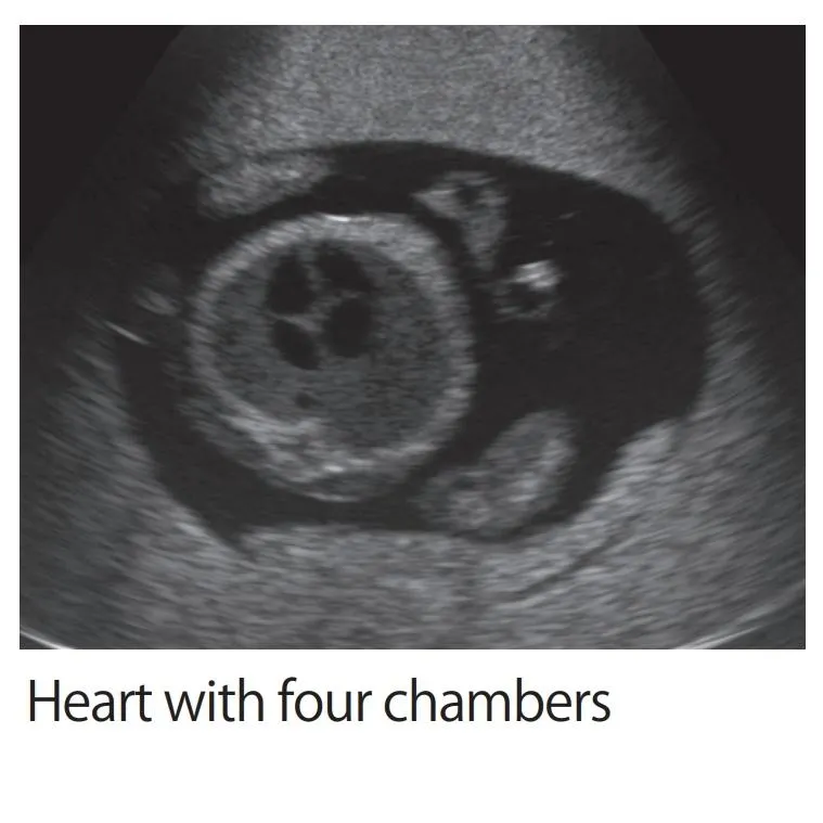 Fetus Ultrasound Exam Phantom SPACE FAN-ST