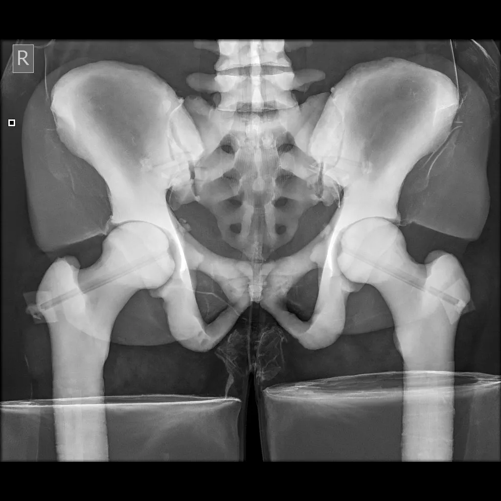 Full Body X-Ray and Radiographic Positioning Manikin