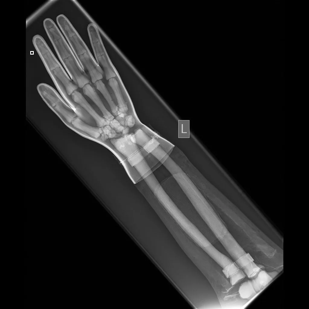 Full Body X-Ray and Radiographic Positioning Manikin