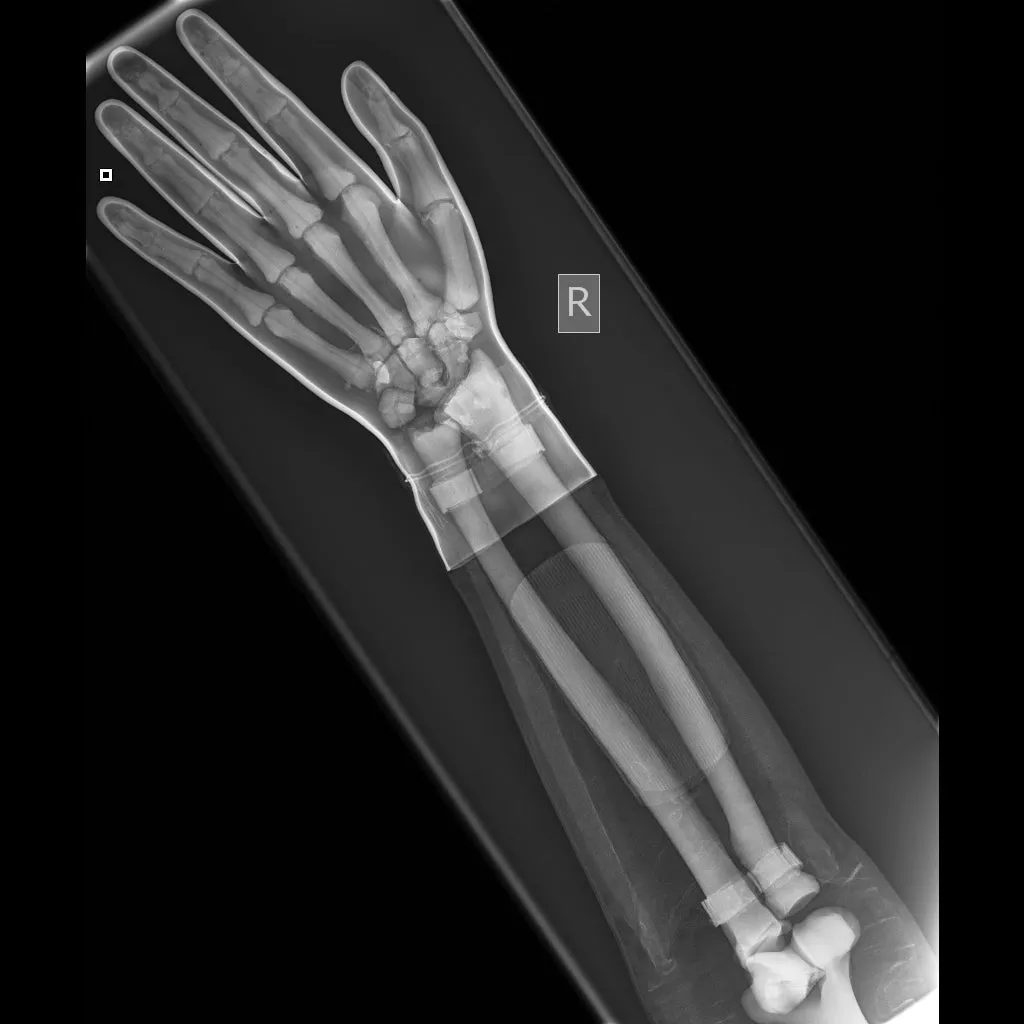 Full Body X-Ray and Radiographic Positioning Manikin