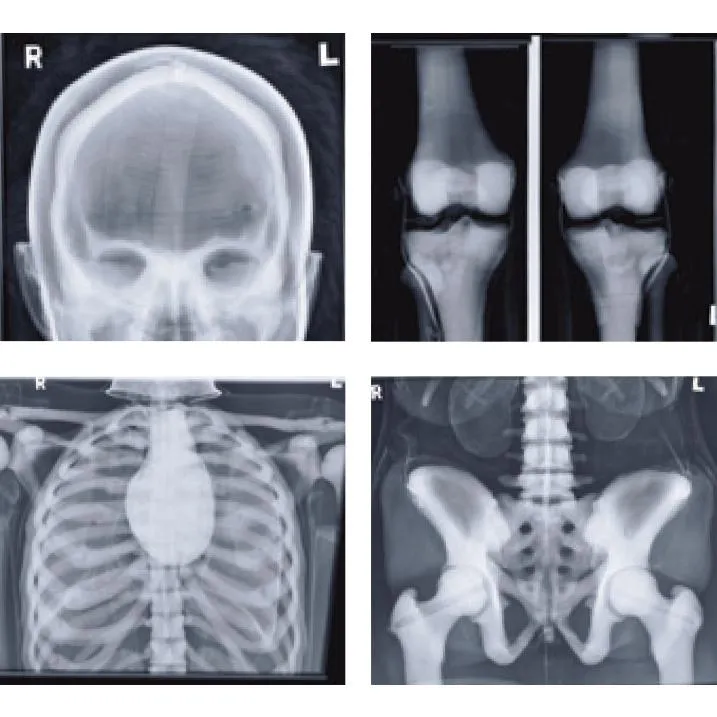Full Body X-Ray and Radiographic Positioning Manikin