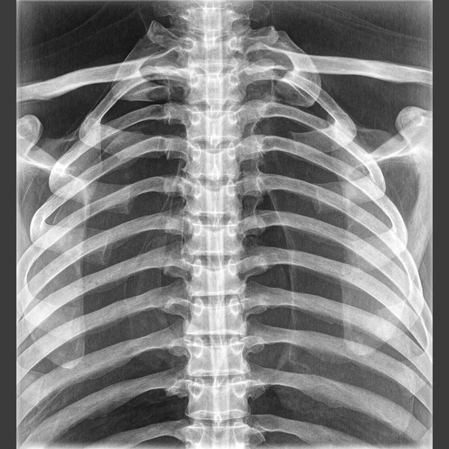 Full Body X-Ray Phantom with Real Human Skeleton Bones
