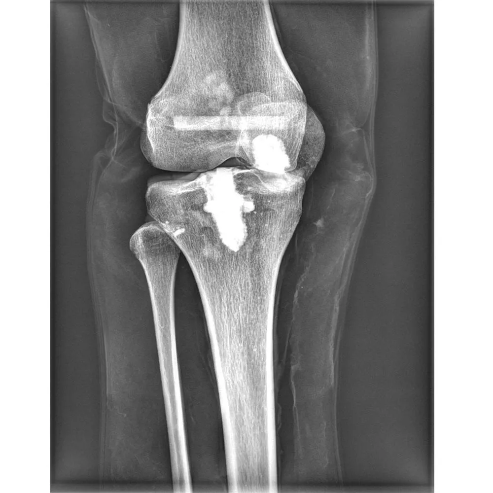 Full Body X-Ray Phantom with Real Human Skeleton Bones