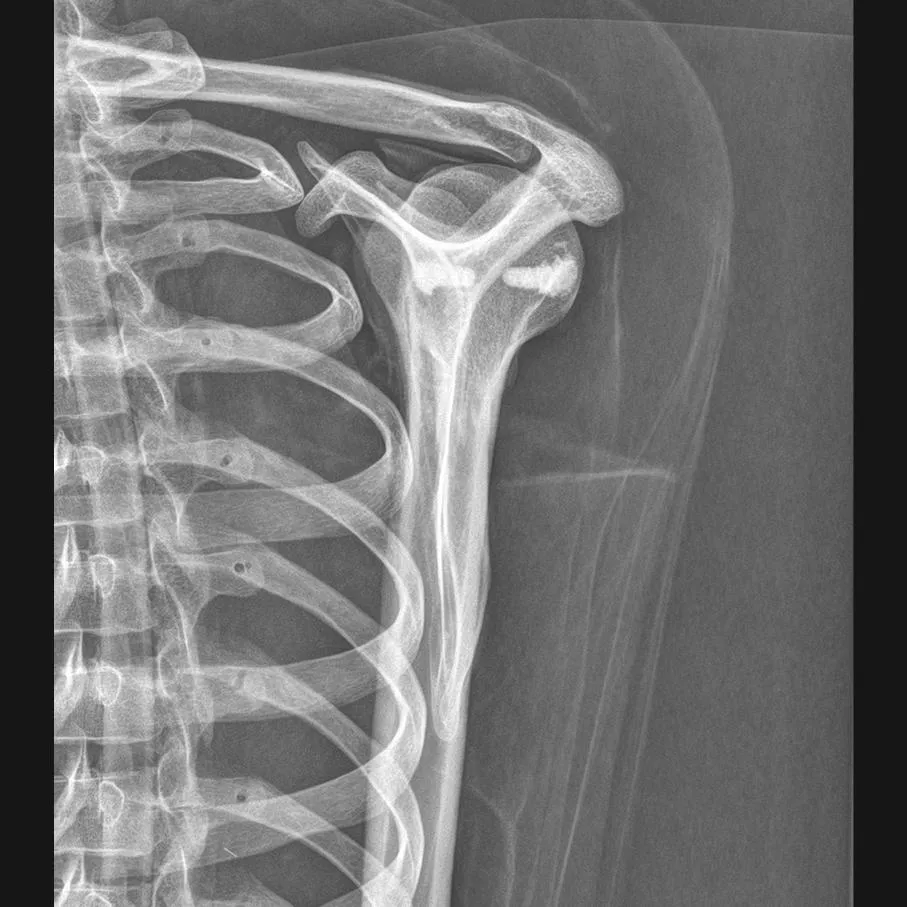 Full Body X-Ray Phantom with Real Human Skeleton Bones