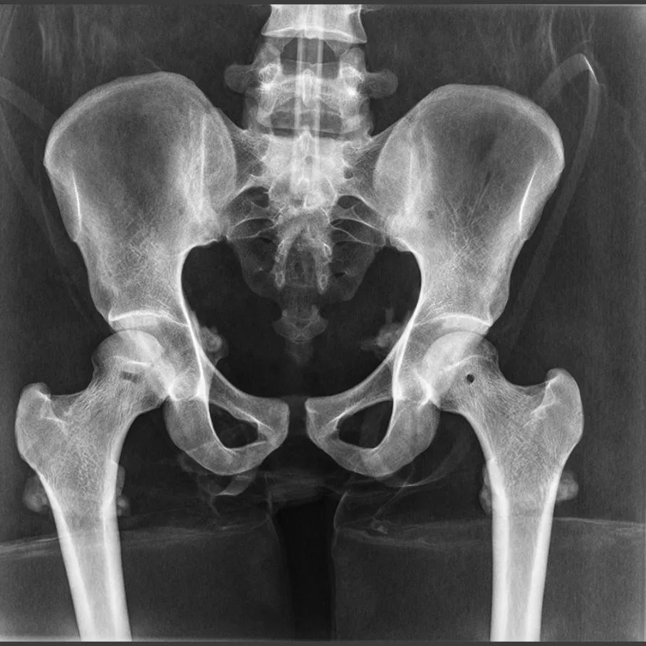 Full Body X-Ray Phantom with Real Human Skeleton Bones