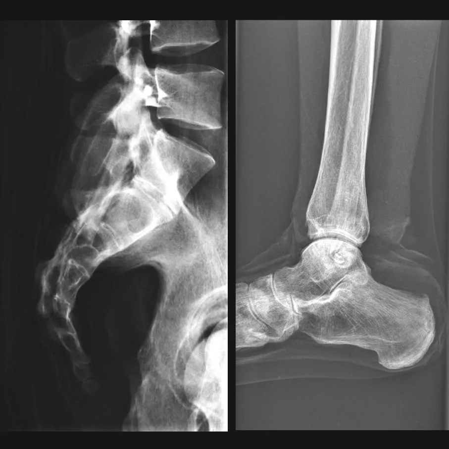 Full Body X-Ray Phantom with Real Human Skeleton Bones