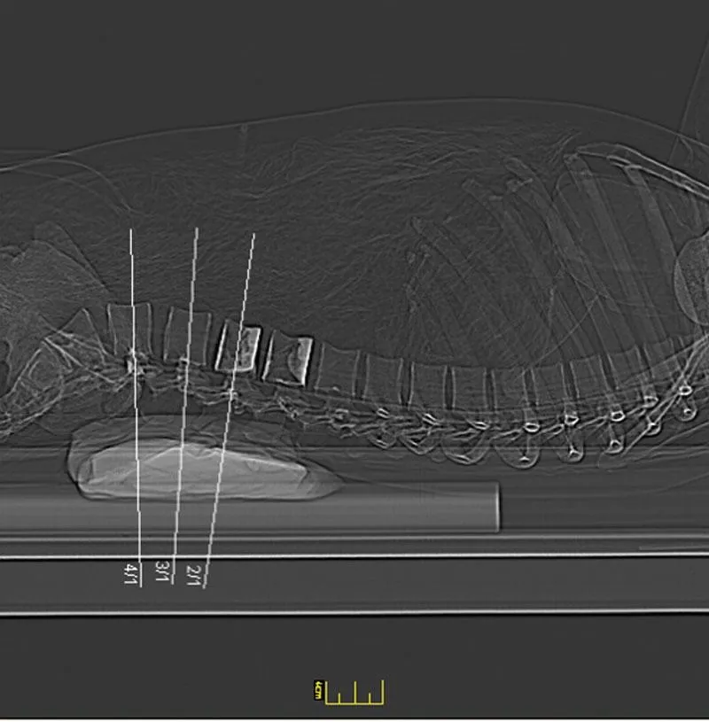 Full Body X-Ray Phantom with Real Human Skeleton Bones