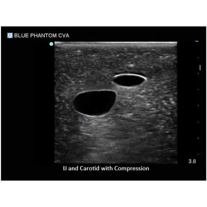 Gen II Ultrasound Central Line Model with Transparent Insert