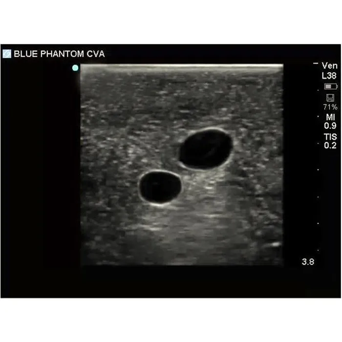 Gen II Ultrasound Central Line Model with Transparent Insert