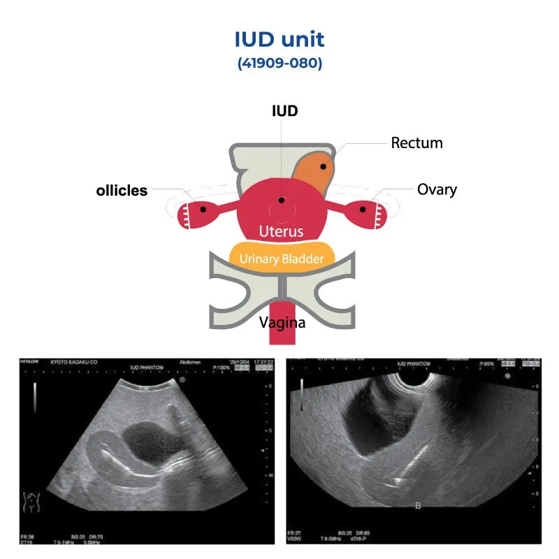 IUD Unit