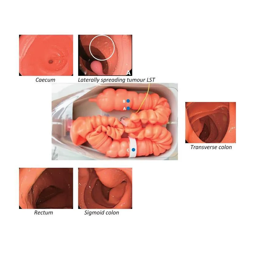 Koken Colonoscopy (Lower GI Endoscopy) Simulator Type II