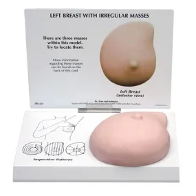Left Breast Cancer Model, Life-like