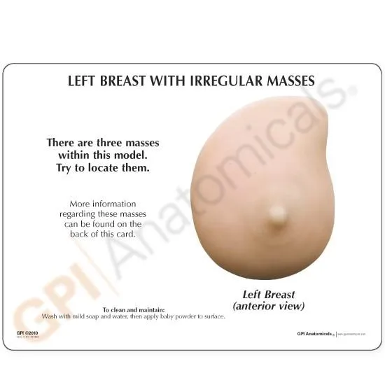 Left Breast Cancer Model, Life-like