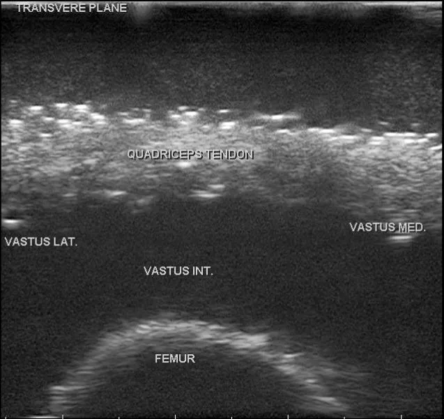 MSK Knee Ultrasound Training Model