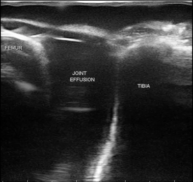 MSK Knee Ultrasound Training Model