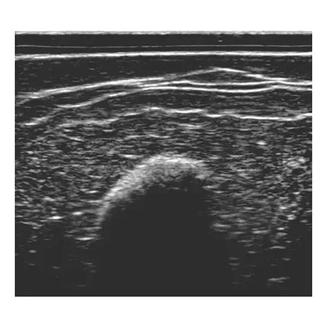Pressure Sores Simulator