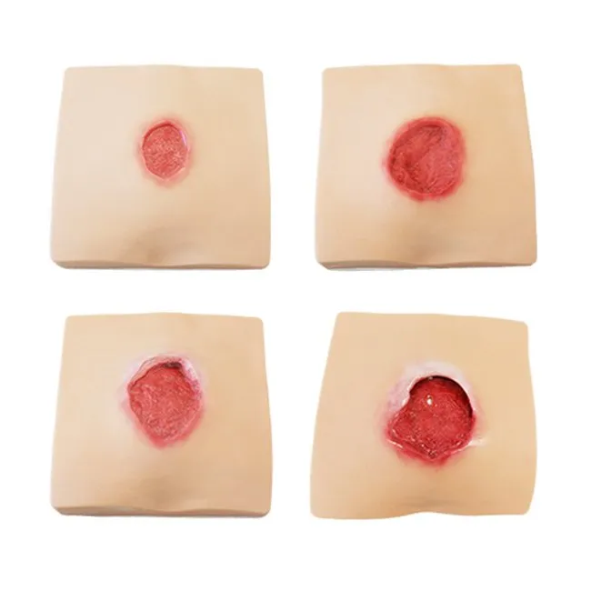 Pressure Sores Simulator