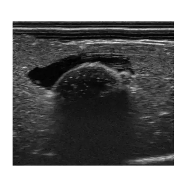Pressure Sores Simulator