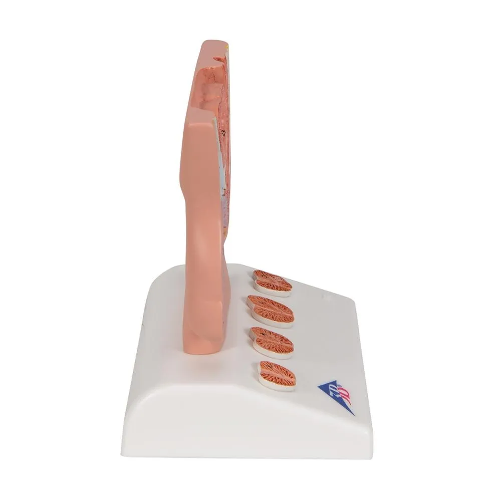 Prostate Model, 1-2 natural size