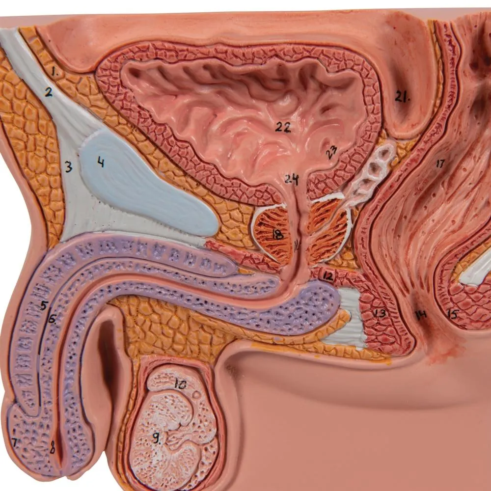 Prostate Model, 1-2 natural size