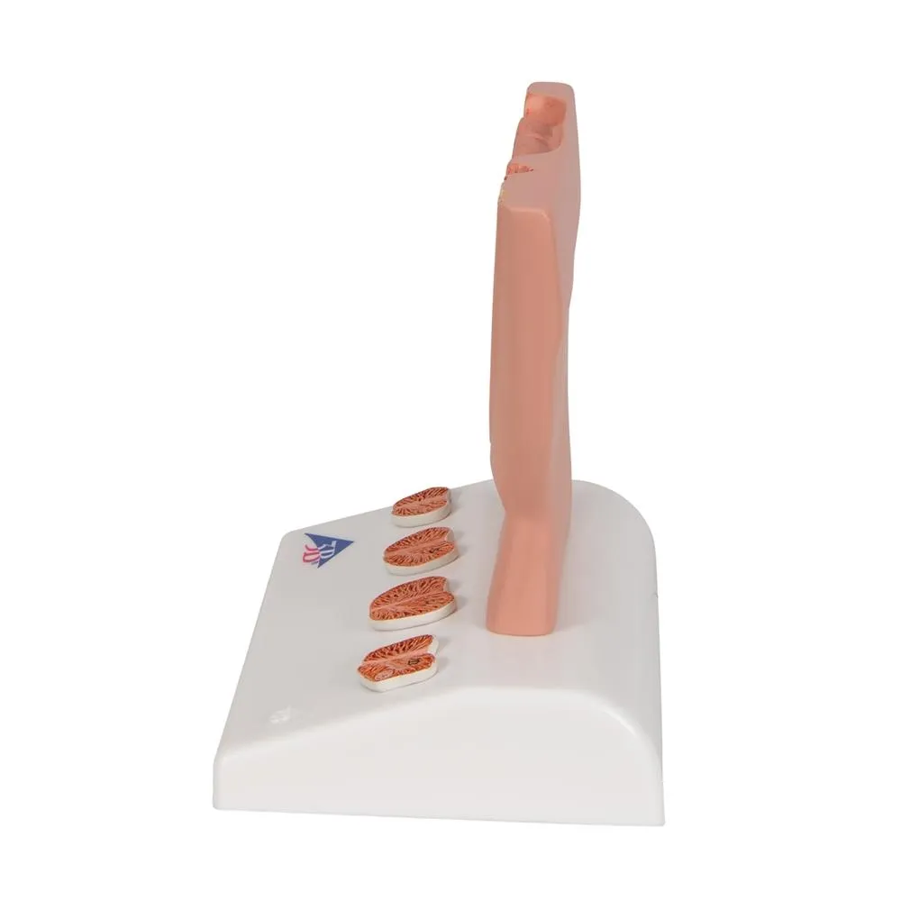 Prostate Model, 1-2 natural size