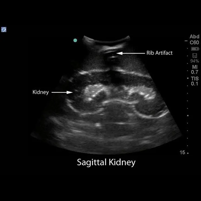 Renal Biopsy Ultrasound Training Model