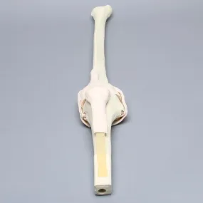 Replacement Knee Insert, Arthroscopy