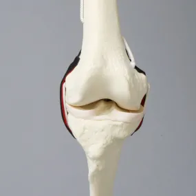 Replacement Knee Insert, Encapsulated ACL with Adjustable Ligament