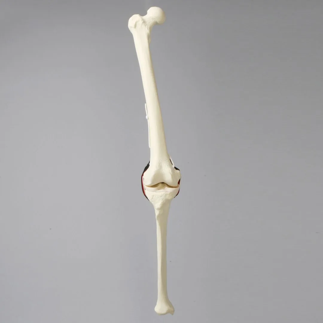 Replacement Knee Insert, Encapsulated ACL with Adjustable Ligament