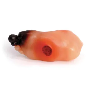 Severe Diabetic Foot Model