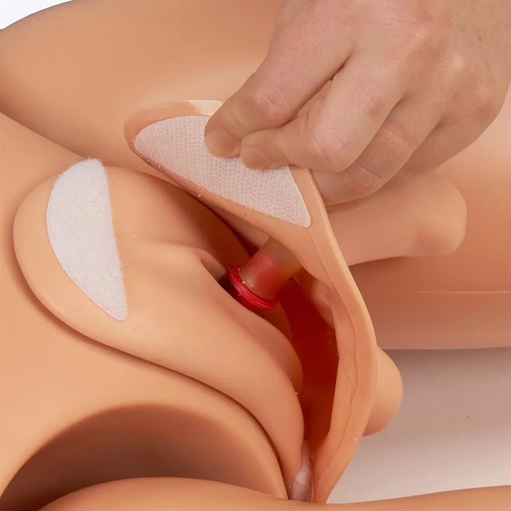 Susie® Simon® Patient Care Simulator with Ostomy, Light