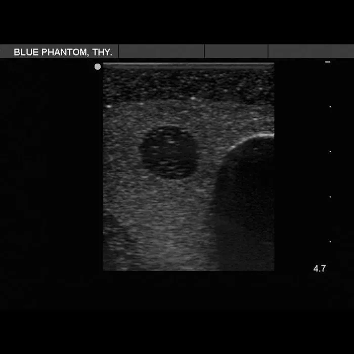 Thyroid Biopsy Ultrasound Training Model