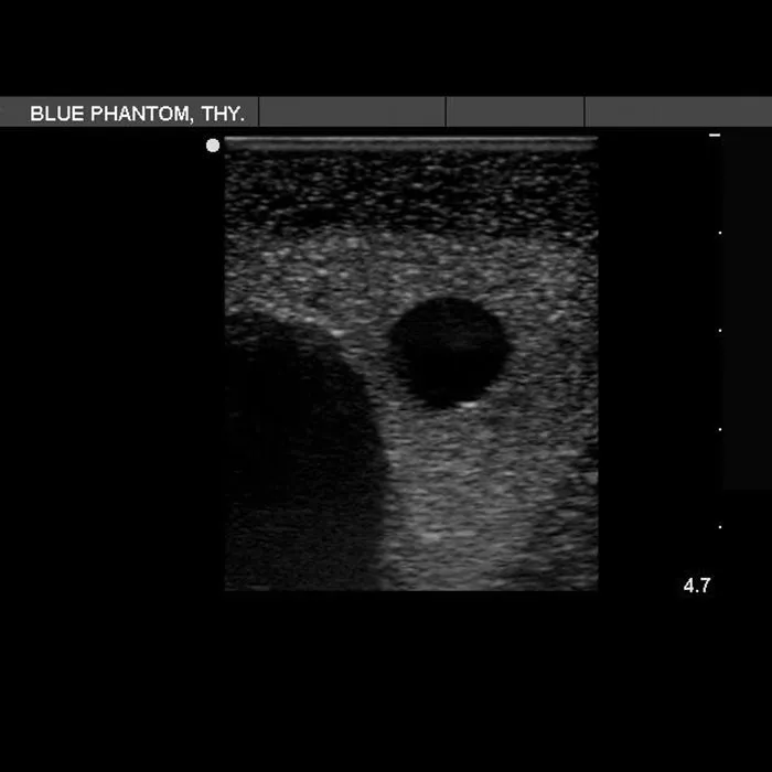Thyroid Biopsy Ultrasound Training Model