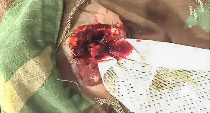 TOMManikin - Tactical Operation Medical Manikin - GSW Injuries