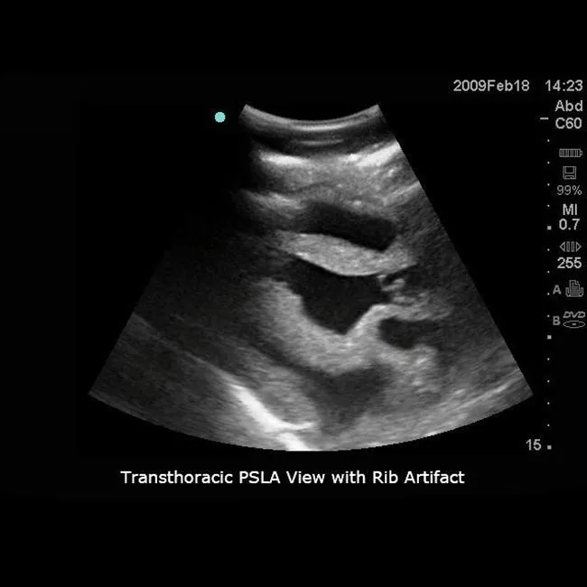 Transthoracic Echocardiography and Pericardiocentesis Ultrasound Training Model