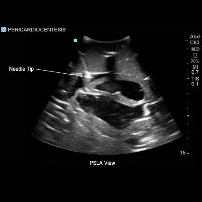 Transthoracic Echocardiography and Pericardiocentesis Ultrasound Training Model