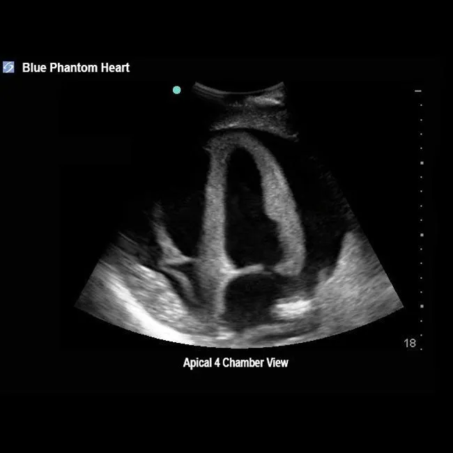 Transthoracic Echocardiography and Pericardiocentesis Ultrasound Training Model