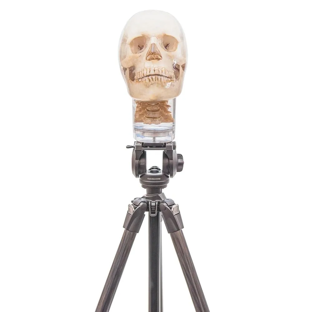 Tripod for X-Ray Phantom Head